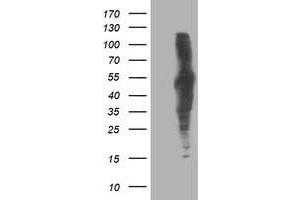 HEK293T cells were transfected with the pCMV6-ENTRY control (Left lane) or pCMV6-ENTRY DLD (Right lane) cDNA for 48 hrs and lysed. (DLD antibody)
