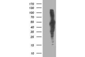 HEK293T cells were transfected with the pCMV6-ENTRY control (Left lane) or pCMV6-ENTRY DLD (Right lane) cDNA for 48 hrs and lysed. (DLD antibody)