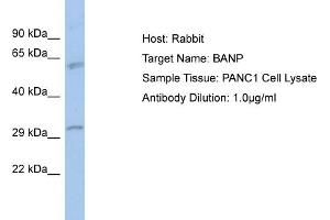 Host: Rabbit Target Name: BANP Sample Type: PANC1 Whole Cell lysates Antibody Dilution: 1. (BANP antibody  (N-Term))