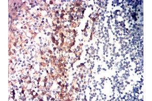 Immunohistochemical analysis of paraffin-embedded tonsil tissues using CD85G mouse mAb with DAB staining. (LILRA4 antibody  (AA 24-178))