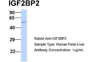 Host:  Rabbit  Target Name:  IGF2BP2  Sample Type:  Human Fetal Liver  Antibody Dilution:  1. (IGF2BP2 antibody  (Middle Region))