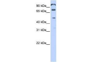 WB Suggested Anti-C10orf38 Antibody Titration:  0. (FAM171A1 antibody  (Middle Region))