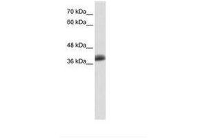 Image no. 1 for anti-SAP30 Binding Protein (SAP30BP) (AA 191-240) antibody (ABIN6736132)