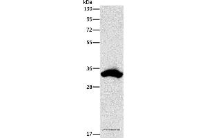 Western blot analysis of 293T cell, using CDCA8 Polyclonal Antibody at dilution of 1:900 (CDCA8 antibody)