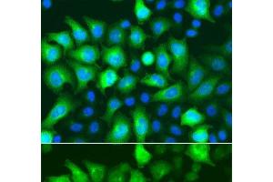 Immunofluorescence analysis of A549 cells using RRM2 Polyclonal Antibody (RRM2 antibody)