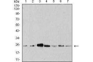 Western Blotting (WB) image for anti-Anaphase Promoting Complex Subunit 10 (ANAPC10) (AA 1-185) antibody (ABIN5542270)