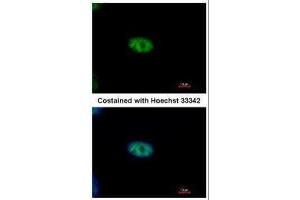 ICC/IF Image Immunofluorescence analysis of paraformaldehyde-fixed A549, using NYREN18, antibody at 1:500 dilution. (NUB1 antibody  (C-Term))