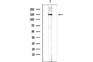 Western blot analysis of lysates from COLO205 cells(heat-shock treatment), using Phospho-Vinculin (Tyr822) Antibody at 1/1000 dilution.