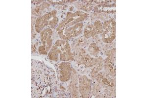 Immunohistochemical analysis of (ABIN392043 and ABIN2841811) on paraffin-embedded Human kidney tissue. (ROR1 antibody)