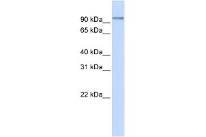WB Suggested Anti-PDXDC1 Antibody Titration: 0. (PDXDC1 antibody  (N-Term))