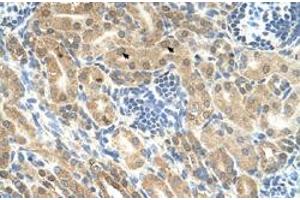Immunohistochemical staining (Formalin-fixed paraffin-embedded sections) of human kidney with IHH polyclonal antibody  at 4-8 ug/mL working concentration. (Indian Hedgehog antibody  (N-Term))