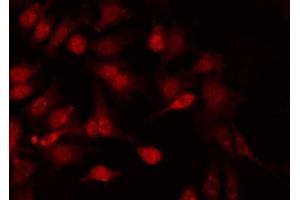 Immunofluorescence (fixed cells) (IF/ICC) image for anti-Nuclear Factor-kB p65 (NFkBP65) (pSer281) antibody (ABIN6255162)