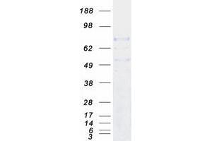 Validation with Western Blot (DNAI1 Protein (Myc-DYKDDDDK Tag))