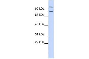WB Suggested Anti-DAGLB Antibody Titration: 0.