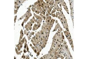 IHC analysis of RBPMS using anti-RBPMS antibody (ABIN7602120). (RBPMS antibody  (AA 6-196))