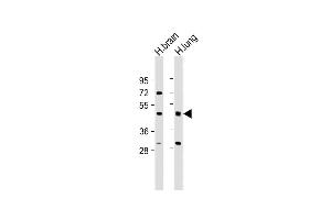All lanes : Anti-IFT57 Antibody (Center) at 1:2000 dilution Lane 1: Human brain lysate Lane 2: Human lung lysate Lysates/proteins at 20 μg per lane. (IFT57 antibody  (AA 159-193))