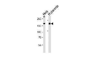 Western blot analysis of lysates from Hela cell line and human placenta tissue lysate(from left to right), using COL4A1 Antibody at 1:1000 at each lane.