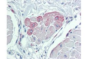 Immunohistochemistry (IHC) image for anti-Transient Receptor Potential Cation Channel, Subfamily M, Member 2 (TRPM2) (N-Term) antibody (ABIN2781840) (TRPM2 antibody  (N-Term))