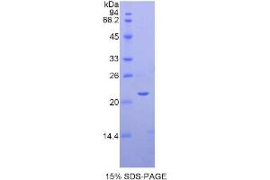 SDS-PAGE (SDS) image for Sema Domain, Immunoglobulin Domain (Ig), Short Basic Domain, Secreted, (Semaphorin) 3F (SEMA3F) (AA 604-785) protein (His tag) (ABIN2122060)