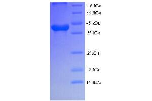 SDS-PAGE (SDS) image for Luteinizing Hormone/Choriogonadotropin Receptor (LHCGR) (AA 27-362) protein (His tag) (ABIN5713606)