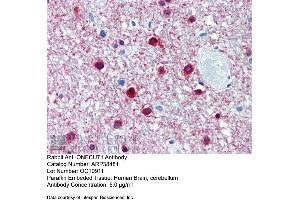 Immunohistochemistry with Human Brain, cerebellum tissue at an antibody concentration of 5. (ONECUT1 antibody  (Middle Region))