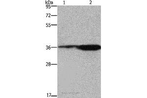 Western blot analysis of 293T cell and mouse brain tissue, using FCAR Polyclonal Antibody at dilution of 1:550 (FCAR antibody)