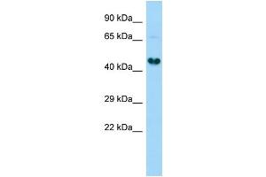 Host:  Rabbit  Target Name:  Gdap1l1  Sample Type:  Rat Kidney lysates  Antibody Dilution:  1. (GDAP1L1 antibody  (C-Term))