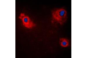 Immunofluorescent analysis of TANK staining in HeLa cells. (TANK antibody  (Center))