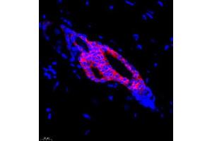 Immunofluorescence of paraffin embedded rat skin using CK13 (ABIN7074412) at dilution of 1:1500 (400x lens)