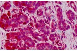Human Breast: Formalin-Fixed, Paraffin-Embedded (FFPE) (Glutathione Peroxidase 1 antibody  (AA 127-193))