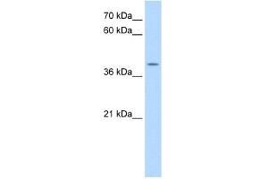 WB Suggested Anti-APOBEC3B Antibody Titration:  0. (APOBEC3B antibody  (N-Term))