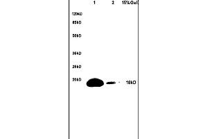 Lane 1: mouse brain lysates Lane 2: mouse heart lysates probed with Anti-phospho-BAD(Ser128) Polyclonal Antibody, Unconjugated (ABIN729478) at 1:200 in 4C. (BAD antibody  (pSer128))