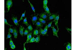 Immunofluorescent analysis of Hela cells using ABIN7144591 at dilution of 1:100 and Alexa Fluor 488-congugated AffiniPure Goat Anti-Rabbit IgG(H+L) (RARS antibody  (AA 201-500))