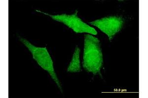 Immunofluorescence of purified MaxPab antibody to KCNIP4 on HeLa cell. (KCNIP4 antibody  (AA 1-250))