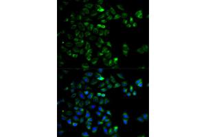 Immunofluorescence analysis of HeLa cells using HTRA2 antibody (ABIN5973384). (HTRA2 antibody)