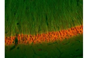 Immunohistochemistry (IHC) image for anti-alpha Tubulin (TUBA1) (AA 443-449) antibody (ABIN1742550) (alpha Tubulin antibody  (AA 443-449))