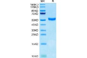 Human CD5 on Tris-Bis PAGE under reduced condition. (CD5 Protein (CD5) (AA 25-371) (His tag))