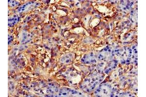Immunohistochemistry of paraffin-embedded human pancreatic tissue using ABIN7145827 at dilution of 1:100