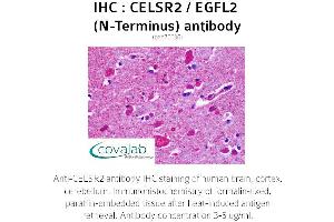 Image no. 2 for anti-Cadherin EGF LAG Seven Pass G-Type Receptor 2 (CELSR2) (Extracellular Domain), (N-Term) antibody (ABIN1732970) (CELSR2 antibody  (Extracellular Domain, N-Term))