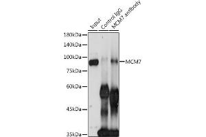 Immunoprecipitation analysis of 300 μg extracts of HeLa cells using 3 μg MCM7 antibody (ABIN3021520, ABIN3021521, ABIN3021522 and ABIN6215189). (MCM7 antibody  (AA 360-719))