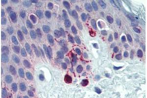 Skin, Human: Formalin-Fixed, Paraffin-Embedded (FFPE) (Tyrosinase-Related Protein 1 antibody  (AA 396-445))