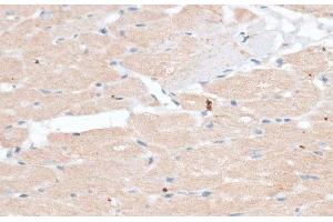 Immunohistochemistry of paraffin-embedded Rat heart using ABCB7 Polyclonal Antibody at dilution of 1:100 (40x lens). (ABCB7 antibody)