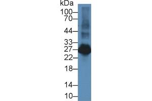 Western Blot; Sample: Rat Spleen lysate; Primary Ab: 2µg/ml Rabbit Anti-Rat LAT2 Antibody Second Ab: 0.