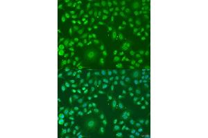 Immunofluorescence analysis of U2OS cells using  antibody (ABIN7265477) at dilution of 1:100. (ARL6 antibody  (AA 1-186))