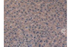 Detection of MEP1b in Rat Liver Tissue using Polyclonal Antibody to Meprin A Beta (MEP1b) (Meprin B antibody  (AA 433-679))