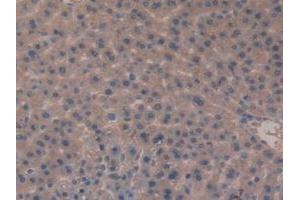 Detection of MEP1b in Rat Liver Tissue using Polyclonal Antibody to Meprin A Beta (MEP1b) (Meprin B antibody  (AA 433-679))