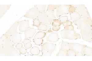 Detection of LOX in Human Skeletal muscle Tissue using Polyclonal Antibody to Lysyl Oxidase (LOX) (LOX antibody  (AA 213-417))