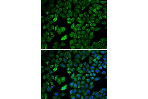 Immunofluorescence analysis of U2OS cells using PRMT5 antibody. (PRMT5 antibody)