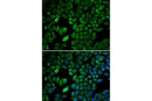 Immunofluorescence analysis of U2OS cells using PRMT5 antibody. (PRMT5 antibody)