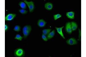 Immunofluorescence staining of A549 cells with ABIN7169172 at 1:50, counter-stained with DAPI. (Sbk2 antibody  (AA 62-330))